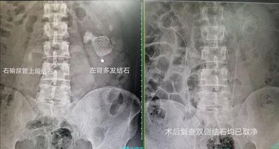 24岁女子天天凌晨2点回家（25岁姑娘凌晨2点被男友抱进急诊室！最终确认：无法恢复！）