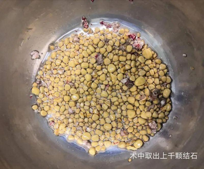 24岁女子天天凌晨2点回家（25岁姑娘凌晨2点被男友抱进急诊室！最终确认：无法恢复！）